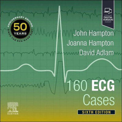 160 ECG Cases | John Hampton (u. a.) | Taschenbuch | Einband - fest (Hardcover)