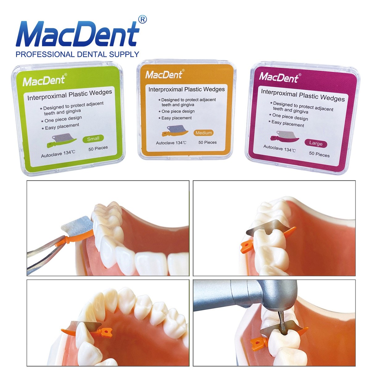 PP-「P」 Dental Wedges Tooth Gap Wedge Diastema Fender Guard Fits Dentsply