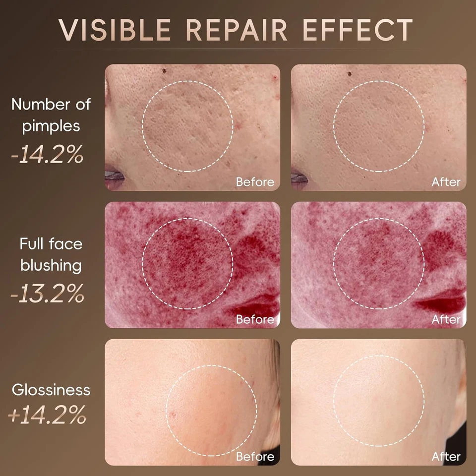 Máscara facial LED de 7 colores terapia de luz roja fotón de arrugas cuidado de la piel máscara de belleza Foto 4 de 4