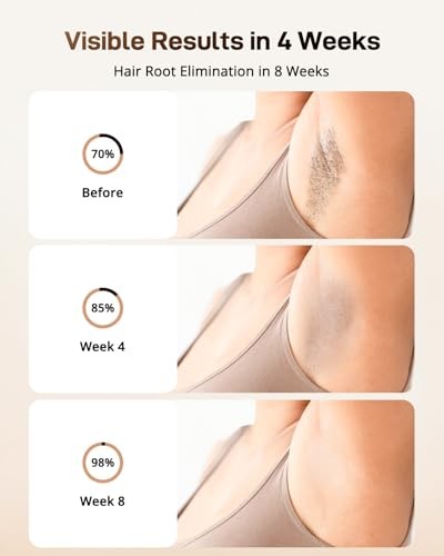 LYSMOSKI LASER HAIR REMOVAL WITH COOLING SYSTEM, IPL HAIR REMOVAL FOR -  WHITE
