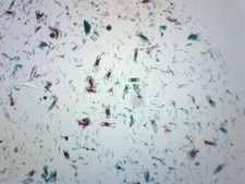 Fungi-Mixed Diatoms - WM - Prepared Slide - 75x25mm - Eisco Labs