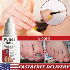 Fungi-Nail Anti-Fungal Liquid Solution Kills Fungus That Can Lead To Nail