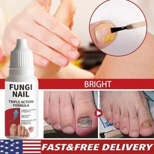 Fungi-Nail Anti-Fungal Liquid Solution Kills Fungus That Can Lead To Nail