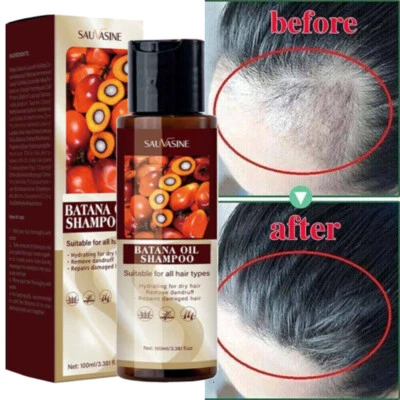 SAUVASINE Hair Growth Shampoo Hair Regrowth Treatment Batana Oil Anti-Hair Loss Shampoo
