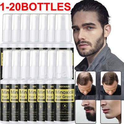 1-20Stk Extra Starke MINOXIDIL 5% Haarwachstum Behandlung Spray Serum FÜR Männer