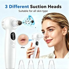 Blackhead Remover Electric Pore Nose Sucker Pimple Skin Acne Face Cleaner-Vacuum