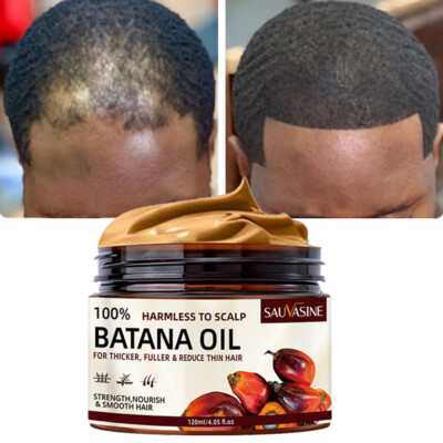 #ad 100% Natural Batana Oil For Hair Growth Healthier Thicker Fuller Anti Hair Loss $8.64