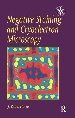 Negative Staining and Cryoelectron Microscopy - 9781859961209