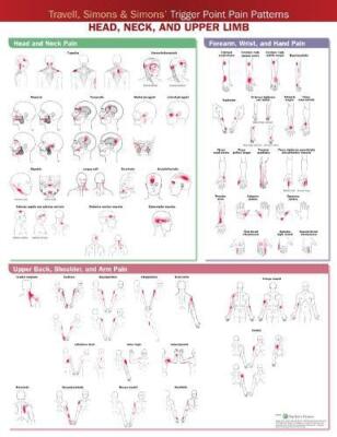 Travell Simons Simons' Trigger Point Pain Patterns Wall Chart b