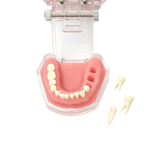 Multiple Types Dental Teeth Model Ortho Implant Practice Teaching Demo Model - Picture 246 of 276