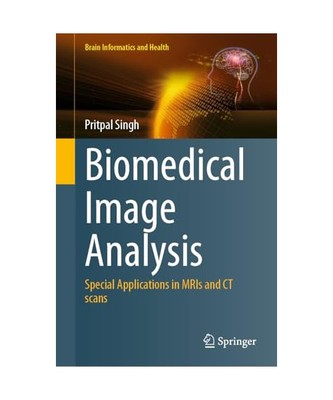 Biomedical Image Analysis: Special Applications in MRIs and CT scans (Brain Info
