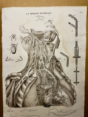 Antiquarische Kupferstisch 1834 Anatomie Medizine Krankheiten Arzt Tattoo Skizze