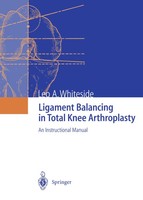 Leo A. Whiteside | Ligament Balancing In Total Knee Arthroplasty | Taschenbuch