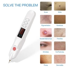 New Plasma Pen Laser Plasma Pen Beauty Equipment for Beauty Care White Machine