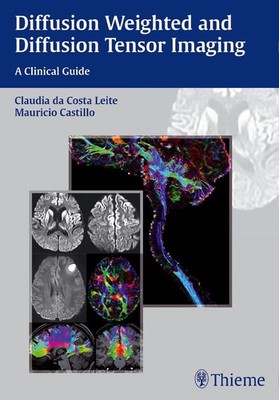 Diffusion Weighted and Diffusion Tensor Imaging | englisch