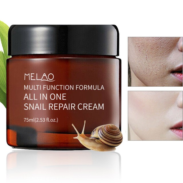 blemish care face cream