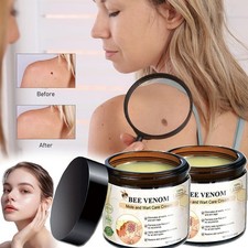 Bee Venom Skin Tag Removal Treatment Cream Body Care Mole Corn Wart Remover 60g