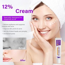 12 Azelaic Acid Cream with Nicotinamide Vitamin C Skin Care Treatment USA