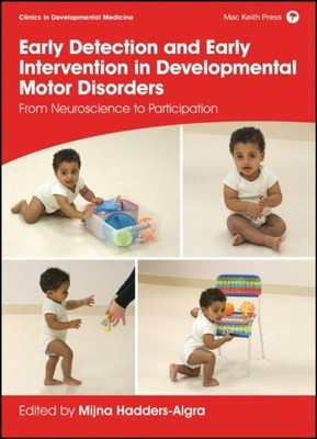 Early Detection and Early Intervention in Developmental Motor Disorders   From  