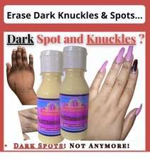 Strong Whitening Dark Knuckles Hands Feets Knees Elbows Armpit Inner Thigh cream