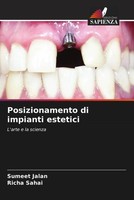 Sumeet Jalan (U. A.) | Posizionamento Di Impianti Estetici | Taschenbuch (2022)
