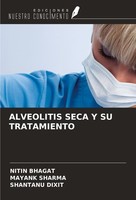 Alveolitis Seca Y Su Tratamiento Nitin Bhagat