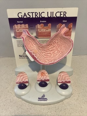 Stomach Human Model Anatomical Pharmaceutical Promotion W/Abnormal Models Nexium