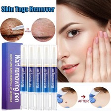 1-5X Warts Removal Pen Eliminate Wart Pen Wart Liquid Flat Condyloma Acuminatum