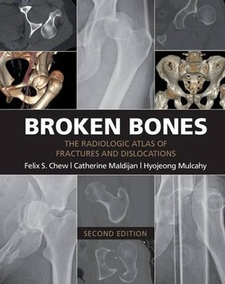 Broken Bones: The Radiologic Atlas of Fractures and Dislocations by Felix S. Che