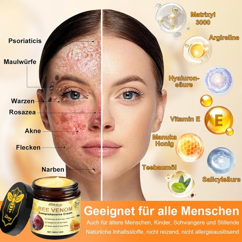Bienengift Gegen Warzen Creme, Bee Venom Creme Bienengiftwarzen- und Etikettenen - Bild 6 von 15