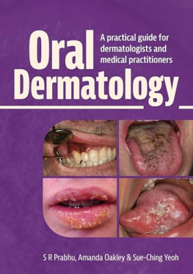 Oral Dermatology: A practical guide for dermatologists  - Hardback NEW Prabhu, S