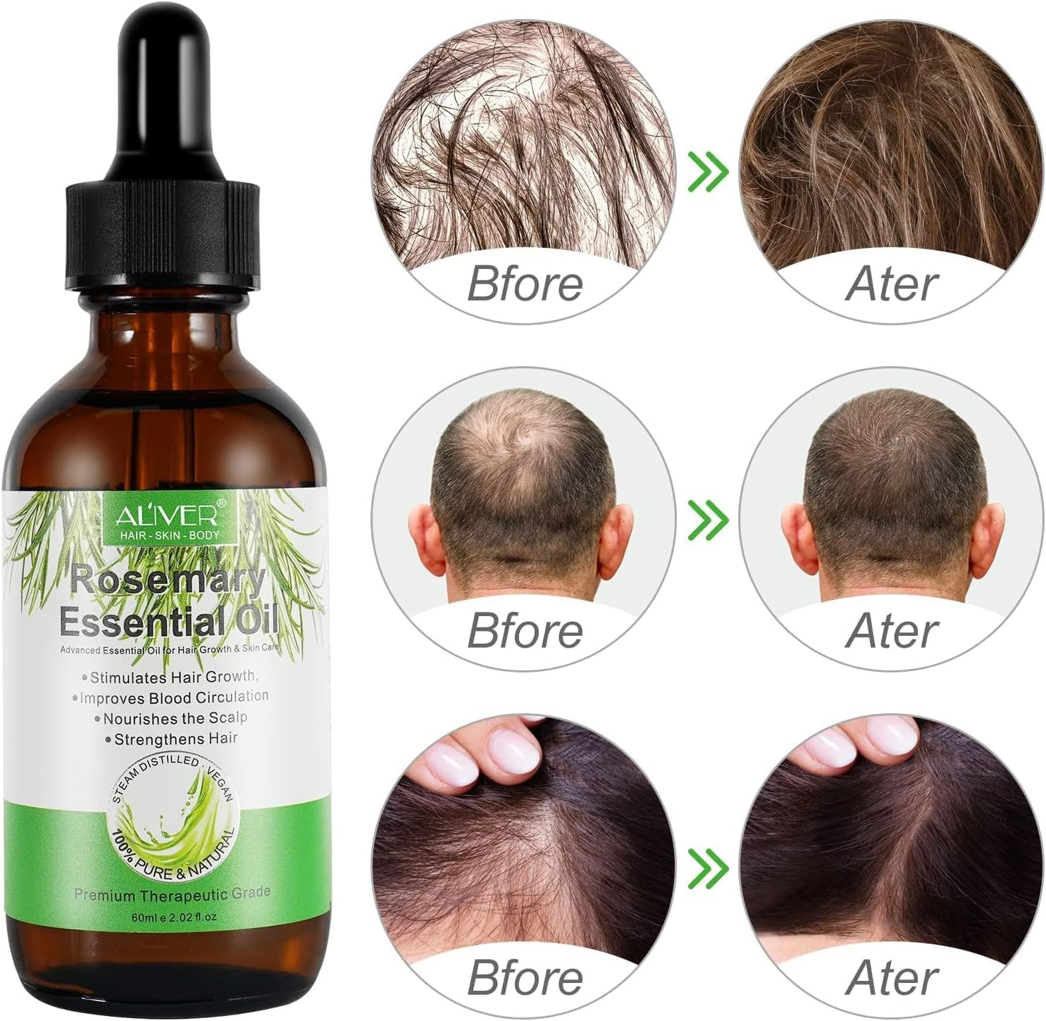 Set 2 Olio Rosmarino Professionale per Infoltimento Capelli - 4