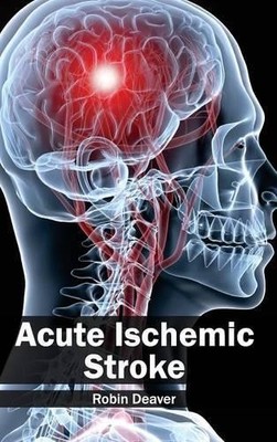 Acute Ischemic Stroke (Hardback)