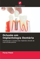 OclusãO Em Implantologia DentáRia Faraz Patel Taschenbuch Portugiesisch 2023
