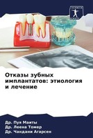 Puq Maity (U. A.) | Otkazy Zubnyh Implantatow: äTiologiq I Lechenie | Buch