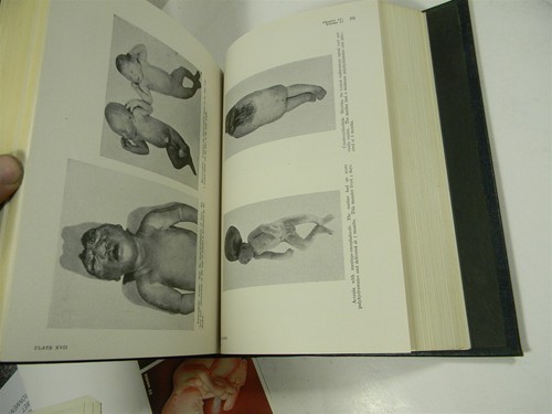1950 Ginecologia e Ostetricia Volume 1 Carl Henry Davis - !32 - 10A - Foto 10 di 12