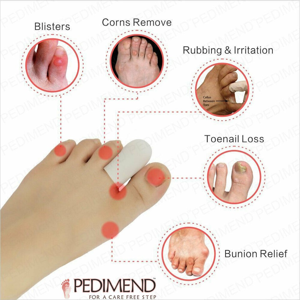 Toenail Guard Pedimend Toe Nail Protector Big Toe protector for Lost Nail Finger Big ...