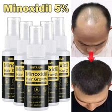 Minoxidil 5 Extra Strength for Men Anti Hair Loss Spray Fast Grow Essence 60ml