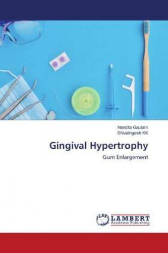 Thumbnail - Gingival Hypertrophy Gum Enlargement 6464