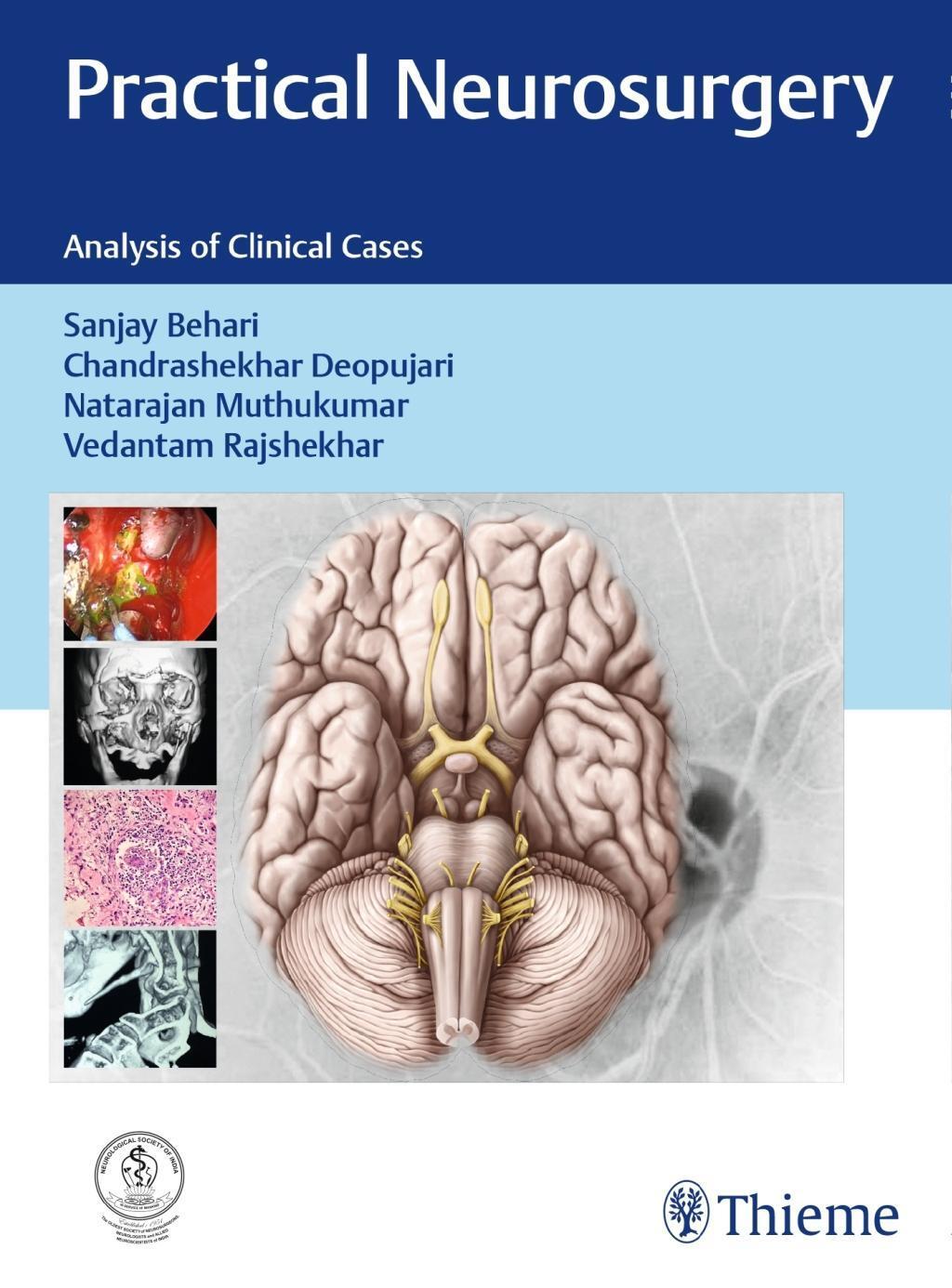 Thumbnail - Practical Neurosurgery Sanjay Behari