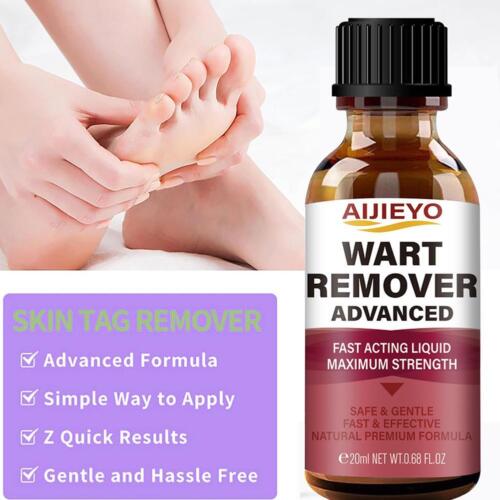Wart Remover Liquid,Fast Acting to Remove Common and Plantar Warts.US - Picture 6 of 11