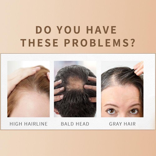 Haarfasern Keratin Verdickungsspray Haaraufbaufasern T6C4 Sofort 9CD3 J6U1 - Picture 9 of 10