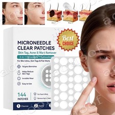 2026 NEW Curalona Microneedle Patches 144pcs, Skin Tag Wart Acne Remover Patches
