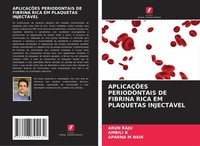 AplicaÇÕEs Periodontais DE Fibrina Rica EM Plaquetas InjectÁVel Arun Raju