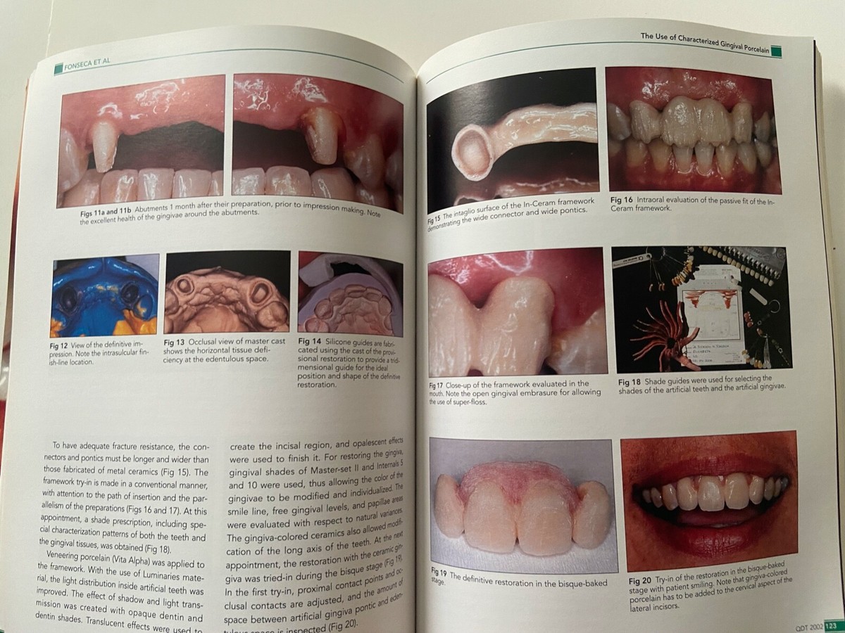 QDT 2002 ~ Quintessence Of Dental Technology ~ Volume 25 ~ OOP | eBay