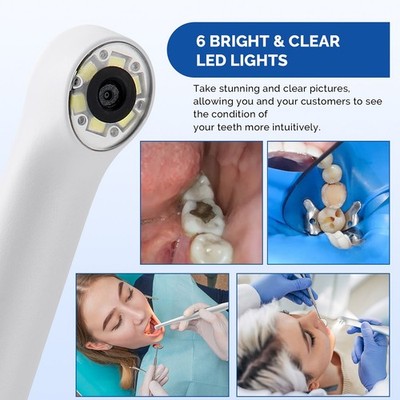 Azdent Dental Intraoral Camera 6 White Light LED Oral Camera Computer USB HD 1280x720P Lab Equipment Dentistry - 66