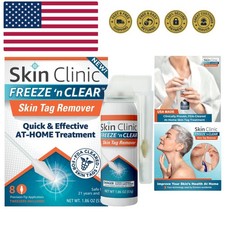 Skin Tag Remover - Cryogenic Kit with 8 Precision-Tip Applicators  Tweezers ...