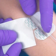 TIDI Grip-Lok Nasal Gastric Securement