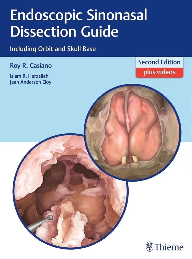 Thumbnail - Endoscopic Sinonasal Dissection Guide