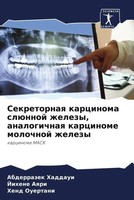Abderrazek Haddaui (U. A.) | Sekretornaq Karcinoma SlüNnoj Zhelezy,...